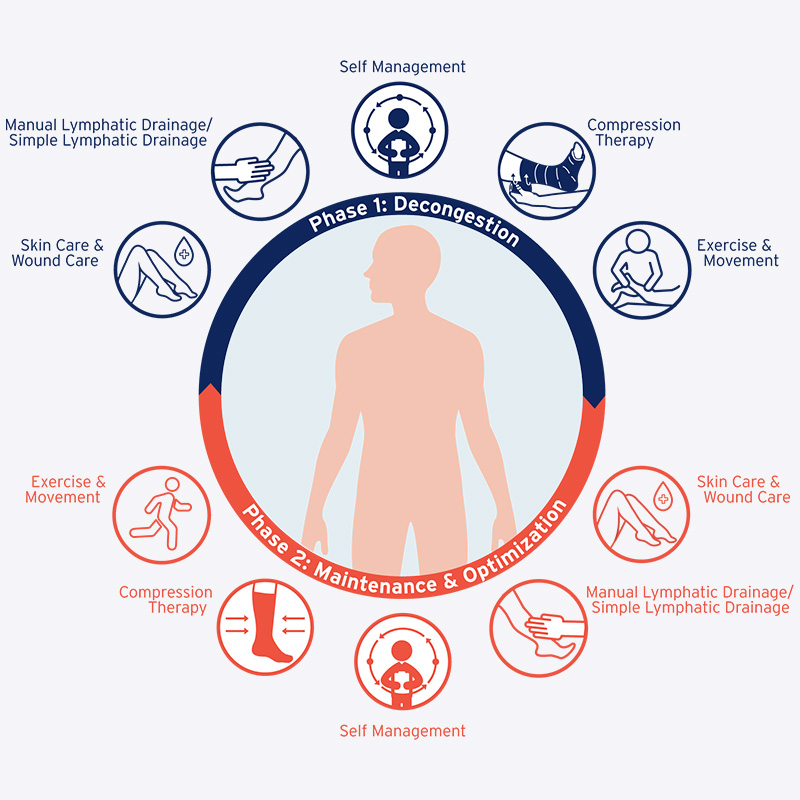 Diagram showing both phases of Complex/Complete Decongestive Therapy and their elements. Diagram showing both phases of Complex/Complete Decongestive Therapy and their elements.